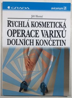 Rychlá kosmetická operace Varixů dolních končetin