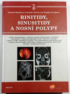 Rinitidy, sinusitidy a nosní polypy